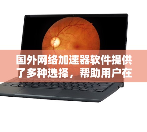 国外网络加速器软件提供了多种选择,帮助用户在手机或电脑上下载和运行软件,尤其是那些需要较大文件或高带宽的应用。以下是一些主要的国外网络加速器软件及其特点 国外网络加速器软件提供了多种选择,帮助用户在手机或电脑上下载和运行软件,尤其是那些需要较大文件或高带宽的应用。以下是一些主要的国外网络加速器软件及其特点